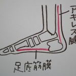 体重が足にかかると痛い！！足底腱膜炎？？