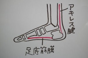 足底腱膜炎　解剖図