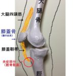 オスグッド症について(子供の膝の痛みの原因は?!)