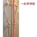 坐骨神経痛について