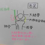 ◆ランナー膝(腸脛靱帯炎)原因と治療◆