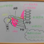 ◇胸郭出口症候群 4つのタイプの原因と治療◇