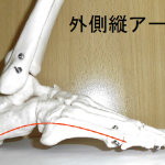 外反母趾は足裏アーチのくずれから始まる?