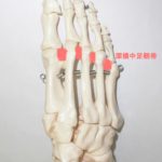 女性に多い開張足、外反母趾の原因に？