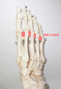 開帳足とは、偏平足と同じように足のアーチが崩れている状態で、外反母趾の要因のひとつです