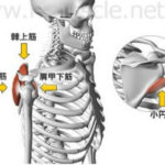 再発しやすい脱臼を防ぐ為には?
