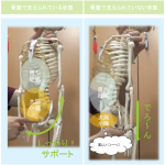 アトピーが良くならないのは骨盤の歪みのせい!?