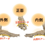 外反母趾になりやすい人の特徴