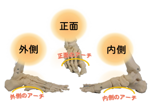 外反母趾になりやすい人の特徴