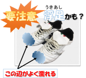 【雨の日につま先がびしょびしょは“浮指”が原因】